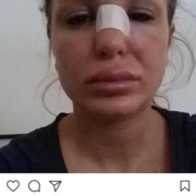 Berk Oktay Merve Şarapçıoğlu'nun yine çıplak fotoğrafları sızdı skandal görüntüler
