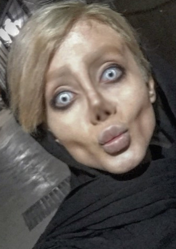 Angelina Jolie’ye benzemek istedi! Sonuç korkunç