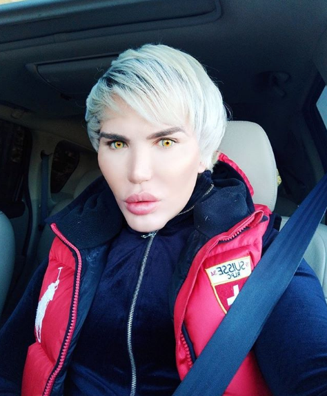 Amacı Barbie bebeğe benzemekti ama yüzü haşlandı son hali şok