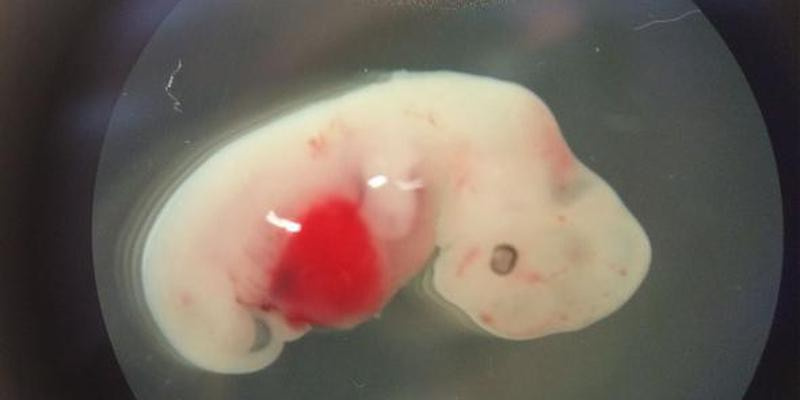 Domuzla insan embriyosunu birleştirdiler sonuç!