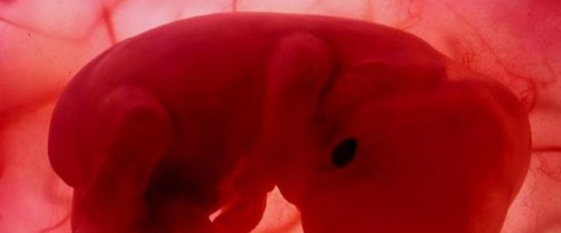 Domuzla insan embriyosunu birleştirdiler sebebine bakın
