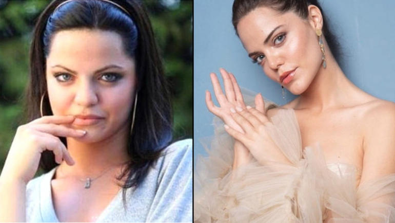 Hilal Altinbilek Kimdir Yasi Kac Neresine Estetik Yaptirdi Internet Haber