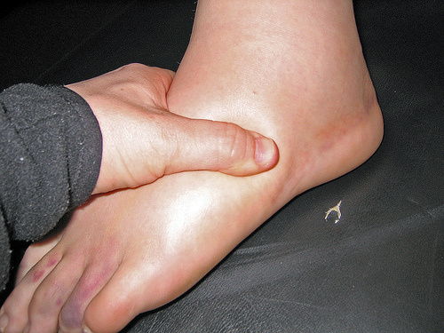 Bacaklarda ve Karında Şişme (Ödem ve Asit) – Dr. Suat GÜNSEL Girne Üniversitesi Hastanesi