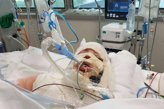 Beyin Olumu Nedir Beyin Olumunde Dirilen Var Mi Internet Haber