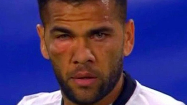 Dani Alves