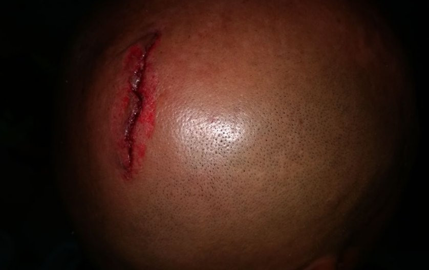 Juventud ve Pergamino