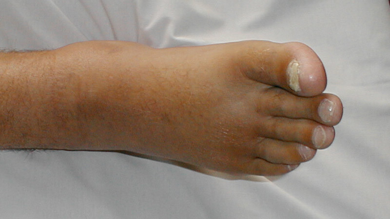 https babacan1717 tr gg ayak 26 23350 3b 26 23304 3b 26 23350 3bmes 26 23304 3b nedenler 26 23304 3b 2c bel 26 23304 3brt 26 23304 3bler 26 23304 3b 2c neye 26 23304 3b 26 23350 3baret eder htm