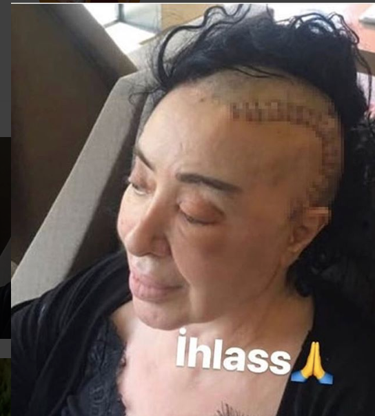 nur yerlitas hastaligi ne son haline bakin dua istedi internet haber