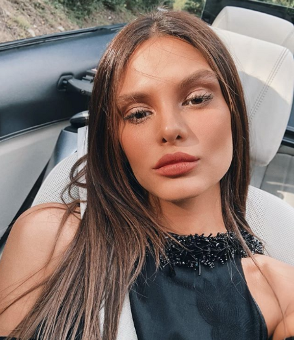 Survivor Almeda'nın inanılmaz değişimi! Estetikle bambaşka birine dönüştü - Sayfa 3