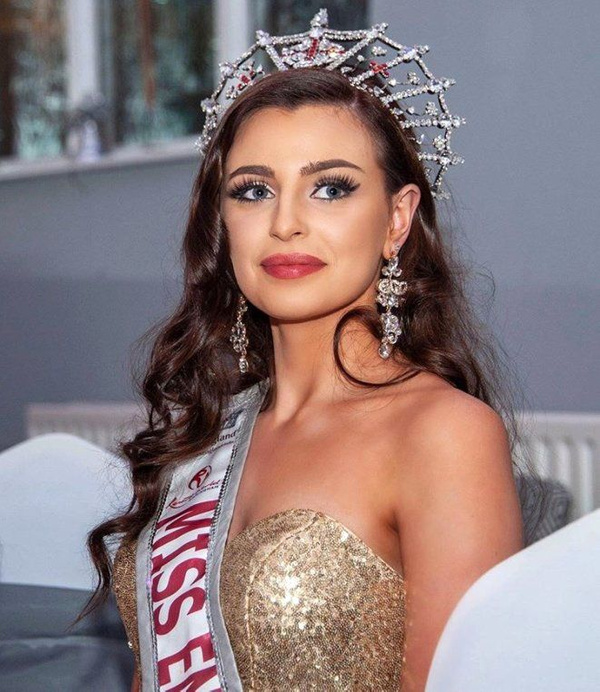 Güzellik kraliçesi Alisha Cowie'den itiraf! 4 yıldır hastalıkla boğuşuyor - Sayfa 3