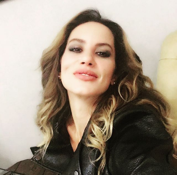 Yıldız Asyalı estetik iddalarını yalanladı! Bakın yüzüne ne olmuş - Sayfa 1