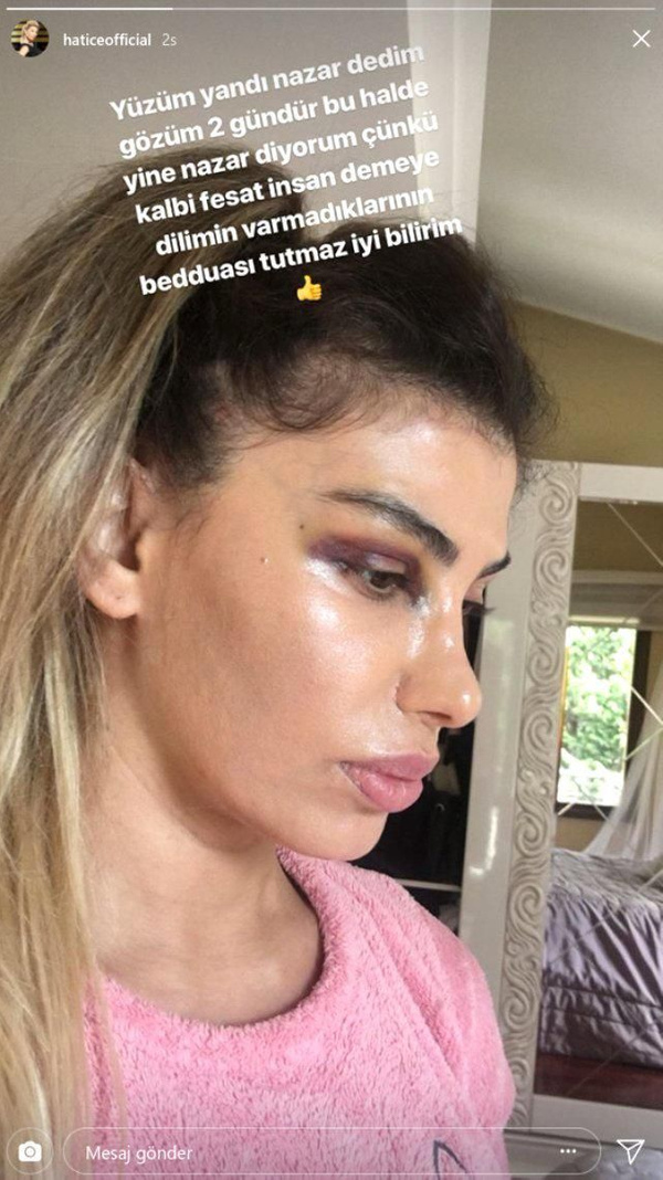 Kalçasını açarak olay olmuştu! Hatice'nin son hali korkuttu! - Sayfa 3