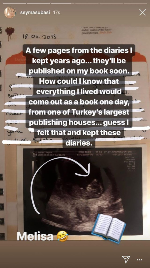 Şeyma Subaşı ilk kez bebeğinin ultrason fotoğrafını paylaştı! Sosyal medya karıştı - Sayfa 3