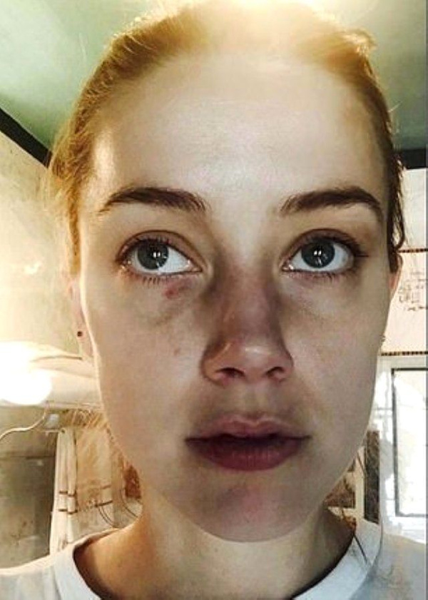 Johnny Depp eski eşi Amber Heard'dan şiddet gördüğünü açıkladı! - Sayfa 2