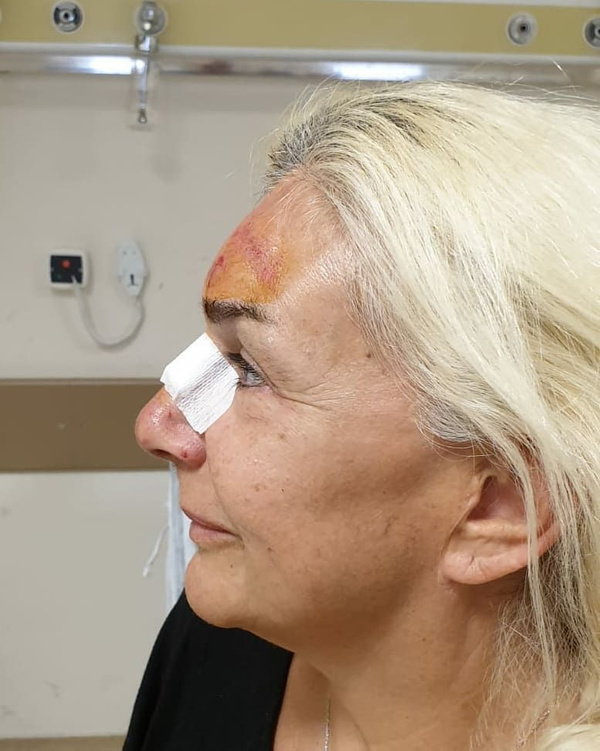 Burçin Orhon tanınmaz hale geldi Süheyl Uygur'un eşinin son görüntüsü korkunç - Sayfa 1