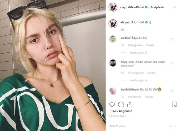 Photoshop'lu fotoğrafı eleştiri yağmuruna tutulmuştu! Aleyna Tilki'den skandal cevap - Sayfa 4