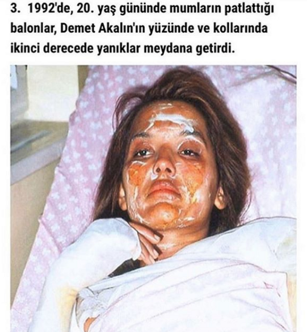 Yanık yüzle tanınmaz hale gelen Demet Akalın o anı ilk kez paylaştı - Sayfa 2