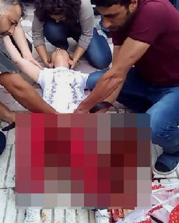 Çorum'da eşini yaralayan kocadan şok sözler - Sayfa 4
