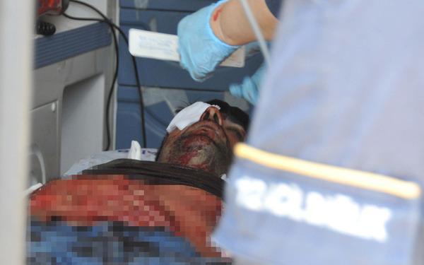 Antalya'da baba ile oğlu arasındaki tartışma hastanede bitti - Sayfa 2