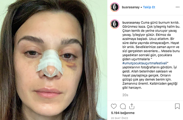 CNN Türk spikeri Büşra Sanay'ın son hali korkunç! Yüzü tanınmaz hale geldi - Sayfa 3
