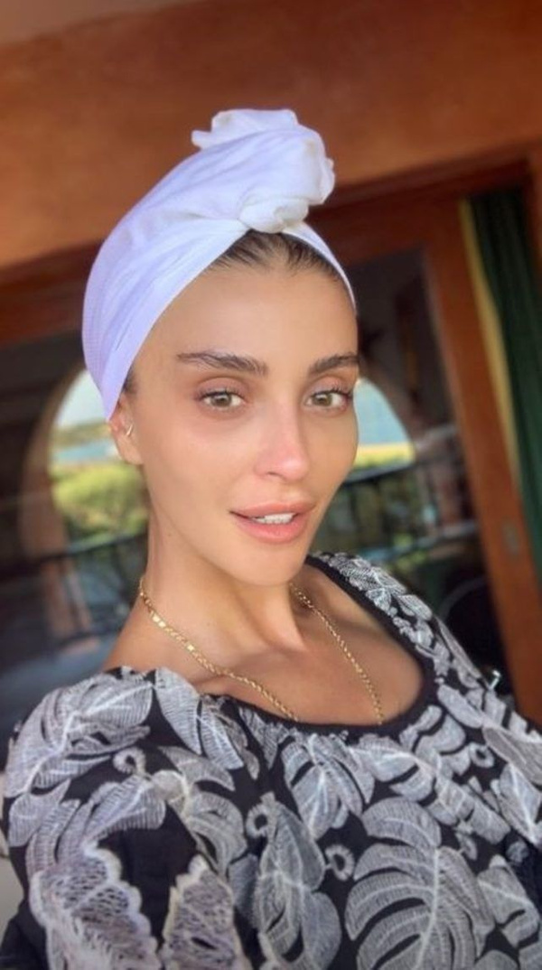 Estetiğim yok diyordu! Özge Ulusoy�un eski hali herkesi şoke etti