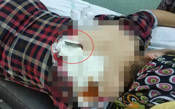 Samsun'da bir kadın sırtına saplanan bıçakla hastaneye kaldırıldı - Sayfa 2