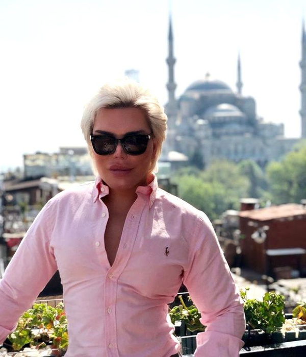 Rodrigo Alves'in son hali korkunç 70 estetik operasyon geçirdi - Sayfa 3