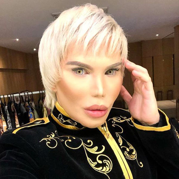 Rodrigo Alves'in son hali korkunç 70 estetik operasyon geçirdi - Sayfa 2