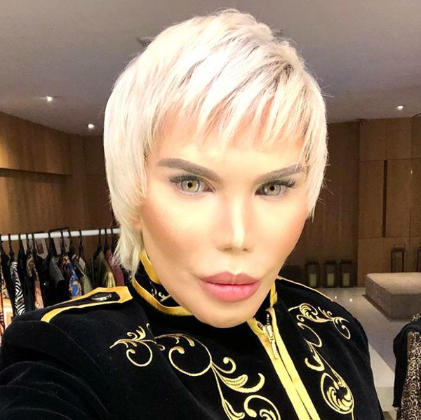 Rodrigo Alves'in son hali korkunç 70 estetik operasyon geçirdi - Sayfa 4