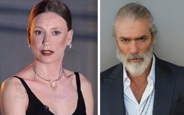 Yaşlandırma akımına uydular! Ünlülerin bu halini görenler gözlerine inanamadı - Sayfa 1