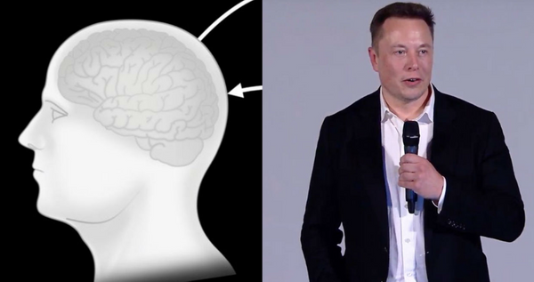 Efsane proje tanıtıldı Elon Musk insan beynini bilgisayara bağlayarak tarihe geçecek - Sayfa 7