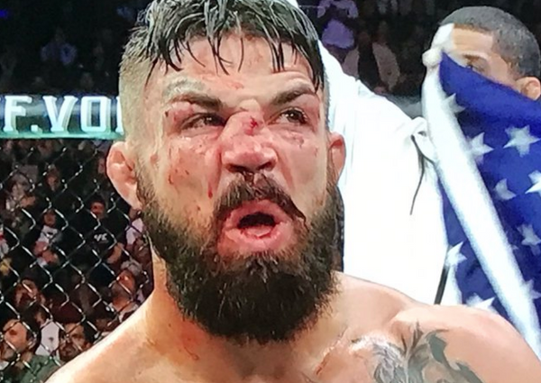 Mike Perry'nin burnu kırıldı suratı tanınmaz hale geldi - Sayfa 3