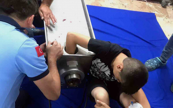 Gaziantep'te bir çocuk elini kıyma makinesine kaptırdı - Sayfa 2