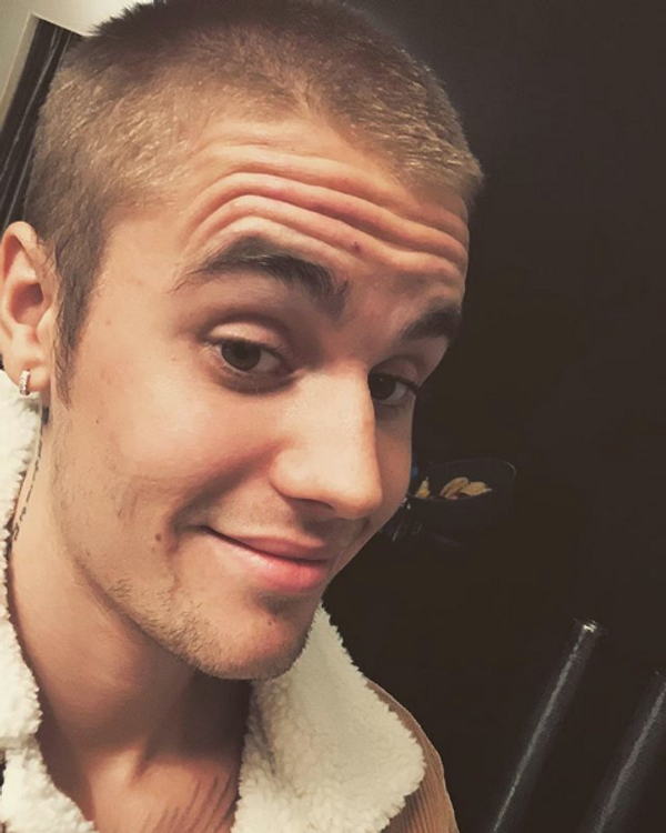 Depresyon tedavisi gören Justin Bieber'ın son hali herkesi korkuttu! Yüzü fena - Sayfa 10
