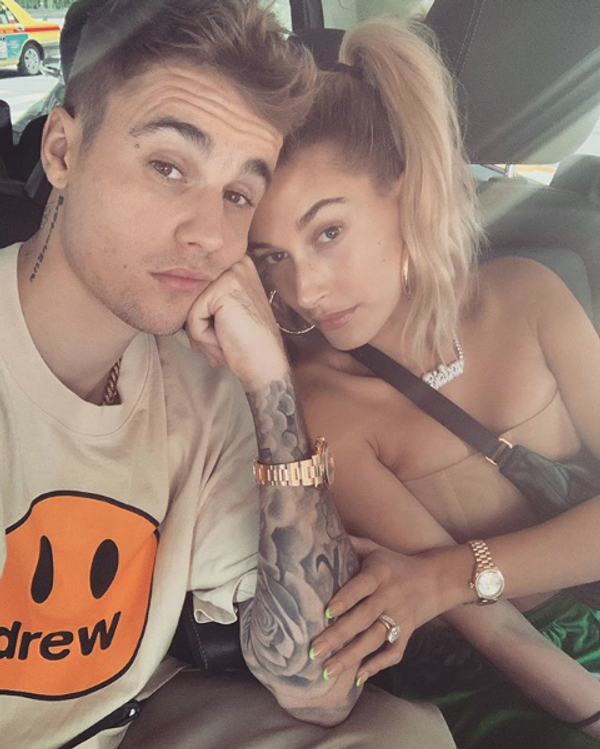 Depresyon tedavisi gören Justin Bieber'ın son hali herkesi korkuttu! Yüzü fena - Sayfa 7
