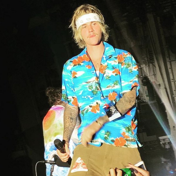 Depresyon tedavisi gören Justin Bieber'ın son hali herkesi korkuttu! Yüzü fena - Sayfa 12