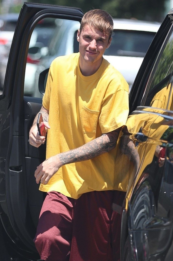 Depresyon tedavisi gören Justin Bieber'ın son hali herkesi korkuttu! Yüzü fena - Sayfa 3