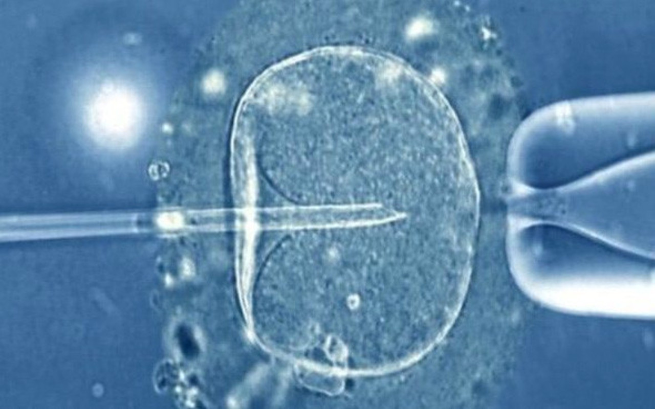 Tüp bebek yaş sınırı kaç oldu şartları ne 32. maddeye Tüp bebek yaş sınırı kaç oldu şartları ne 32. maddeye