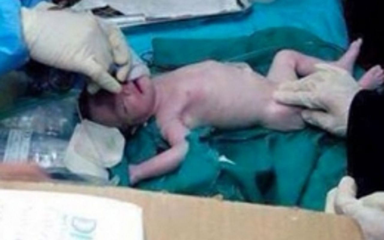 Annesi şehit oldu o kurtuldu Mucize bebek Haber