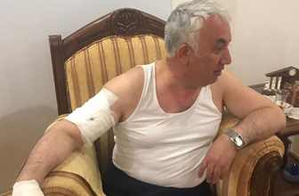 Belediye Başkanına korkunç köpek saldırısı kolunu parçaladı