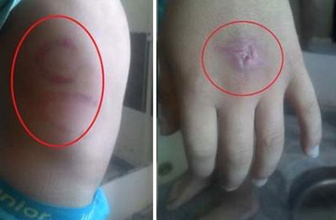 Eli matkapla delindi ısırıldı Van Gölü'ne atıldı! Mucize kurtuluşu anlattı