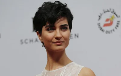 Emina Sandal In Estetik Olmadan Onceki Haline Bakin Internet Haber