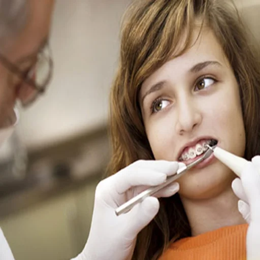 Fastbraces Dis Teli Teknigi Nedir Saglik Haberleri