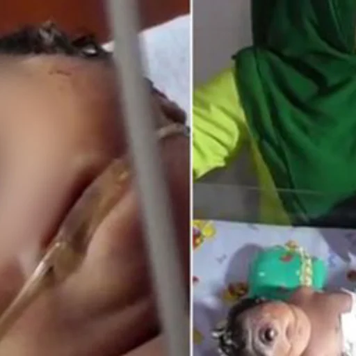 Tek Gozlu Dogan Bebek Gorenleri Sok Etti Internet Haber