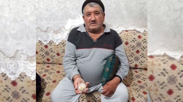 Mesanesinden çıkan doktorları bile şoke etti! Tam 300 gr ve...