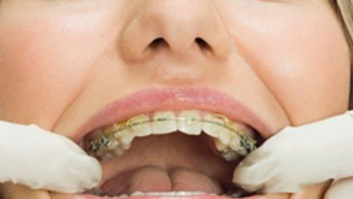 Beyaz dişler için pratik öneriler! Haber