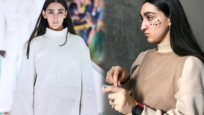 armine harutyunyan in estetikli hali
