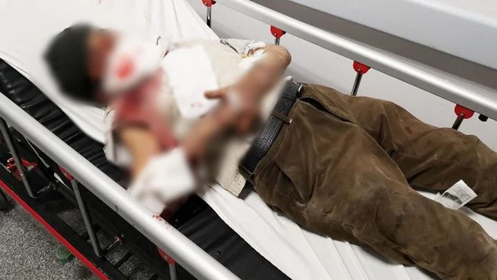 Aksaray'da misafirliğe giden adama köpek saldırdı! Vücudunu parçaladı