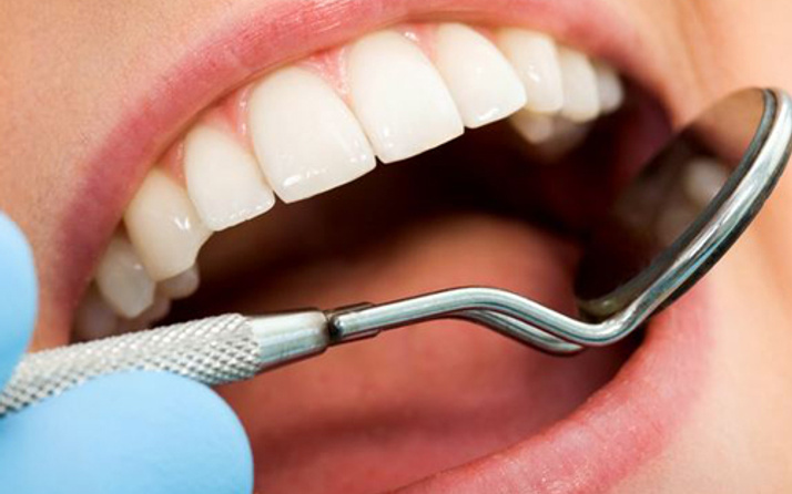 Diş apsesi beyin iltihabına neden olabilir! Sağlık Haberleri