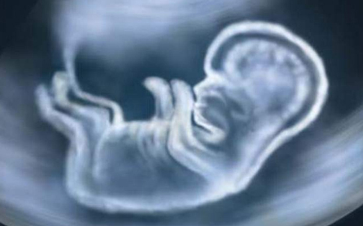 KKTC'de 'yasadışı kürtaj' rezaleti!